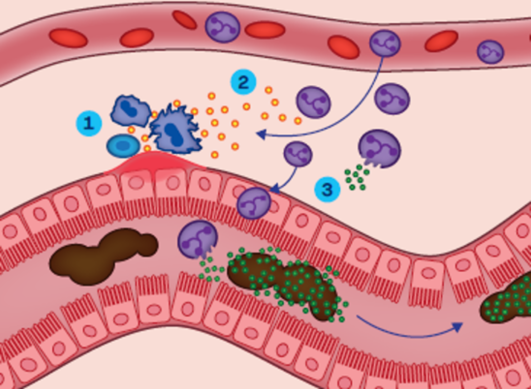 Figure 1. Mechanism of faecal calprotectin release during gastrointestinal inflammation